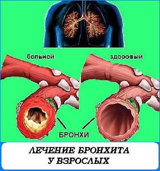 d0bed181d182d180d18bd0b9 d0b1d180d0bed0bdd185d0b8d182