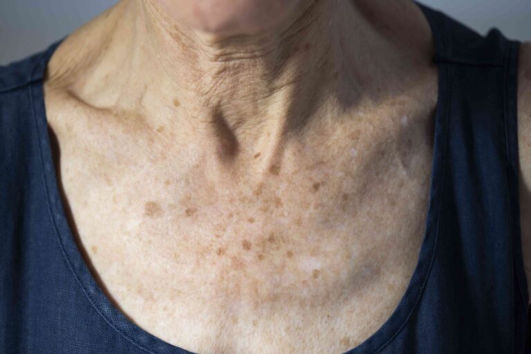 health gettyimages 1131521088 340161f3e4594f749ba6ff8729bb1e1f.jpg