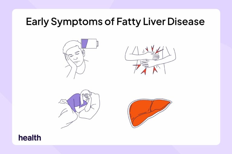 health fatty liver disease symptoms no text 54394f2fc3ba4444abb1084c77edc84c.jpg
