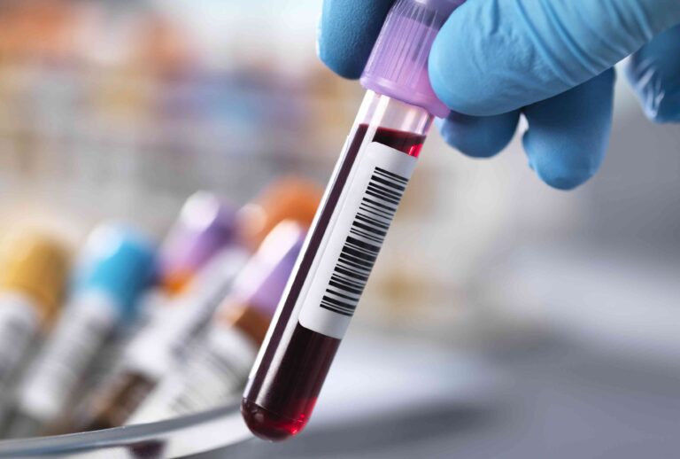 health gettyimages 758303579 351682eb82cf48faae6ea4da5404d5f0.jpg