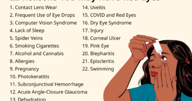 top causes of red eye 34221111 c8c228c886874119b5ceffbceba872c4.png