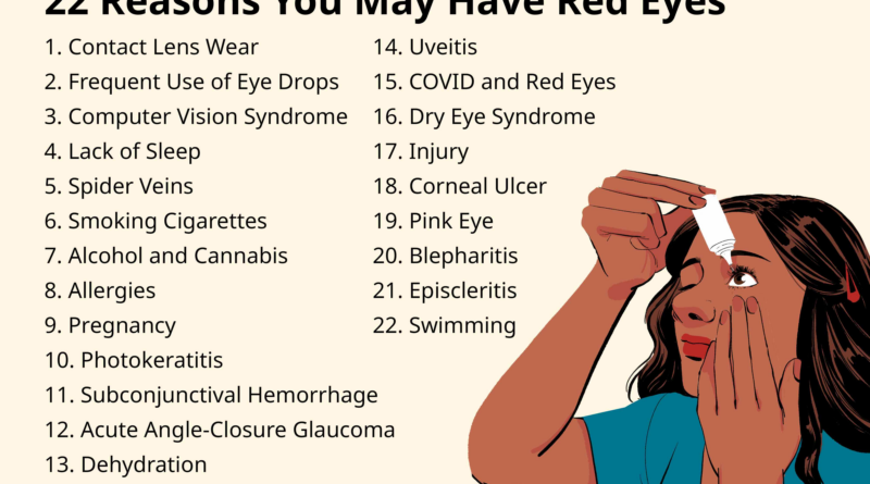 top causes of red eye 34221111 c8c228c886874119b5ceffbceba872c4.png