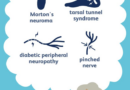 nerve problems that cause foot pain 1337741 final 5bc5fca04cedfd005178d6de.png