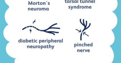 nerve problems that cause foot pain 1337741 final 5bc5fca04cedfd005178d6de.png